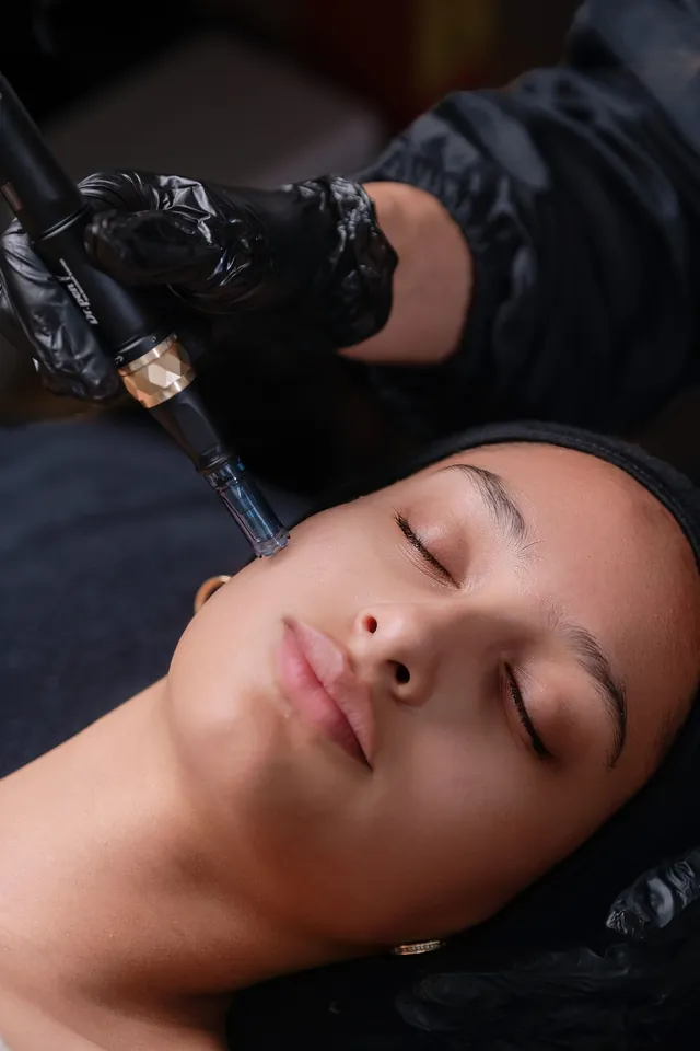 Microneedling pen gliding over a client's forehead during treatment