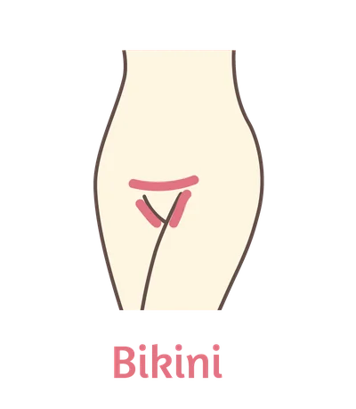 Diagram of the area covered by the Bikini wax